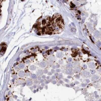 Immunohistochemistry-Paraffin: Tripeptidyl-Peptidase I/TPP1 Antibody [NBP1-85561]