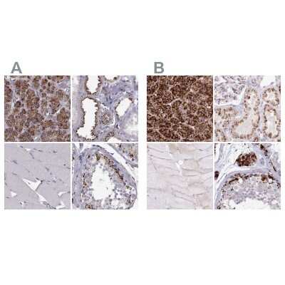 Immunohistochemistry-Paraffin: Tripeptidyl-Peptidase I/TPP1 Antibody [NBP2-48820]