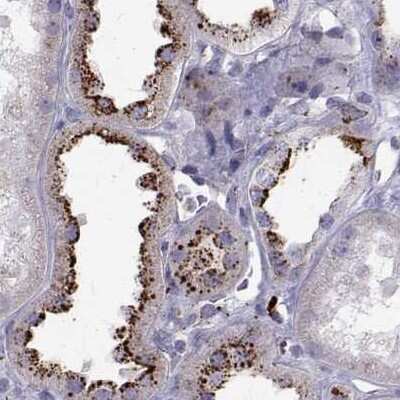 Immunohistochemistry-Paraffin: Tripeptidyl-Peptidase I/TPP1 Antibody [NBP2-48820]