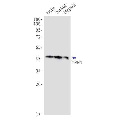 Western Blot: Tripeptidyl-Peptidase I/TPP1 Antibody (S09-2G9) [NBP3-15105]