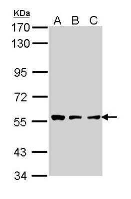 Western Blot: Tripeptidyl-Peptidase I/TPP1 Antibody [NBP1-31758]