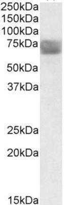 Western Blot: Tripeptidyl-Peptidase I/TPP1 Antibody [NBP1-36742]