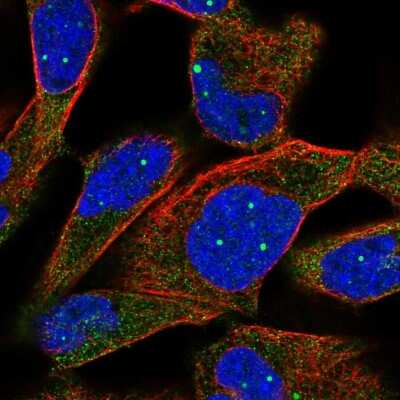 Immunocytochemistry/ Immunofluorescence: Tripeptidyl peptidase II Antibody [NBP2-56785]