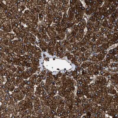 Immunohistochemistry-Paraffin: Tripeptidyl peptidase II Antibody [NBP1-86022]