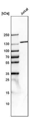 Western Blot: Tripeptidyl peptidase II Antibody [NBP1-86022]