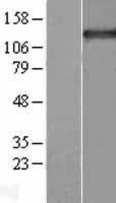 Western Blot: Tripeptidyl peptidase II Overexpression Lysate [NBL1-17224]