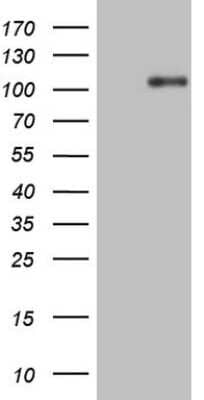 Western Blot: TrkA Antibody (OTI5B6) [NBP2-46266]