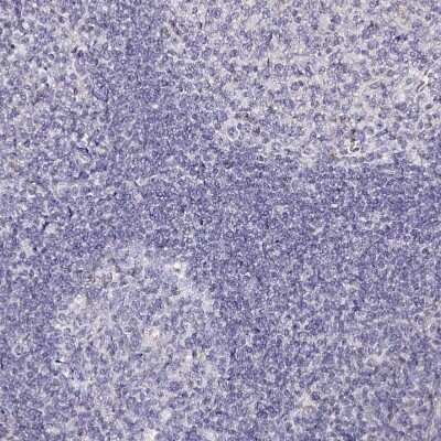 Immunohistochemistry-Paraffin: TrkA Antibody [NBP2-38265]