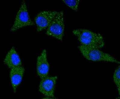 Immunocytochemistry/ Immunofluorescence: TrkA Antibody (JJ084-04) [NBP2-67473]