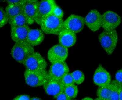 Immunocytochemistry/ Immunofluorescence: TrkA Antibody (JJ084-04) [NBP2-67473]