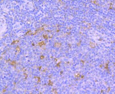 Immunohistochemistry-Paraffin: TrkA Antibody (JJ084-04) [NBP2-67473]