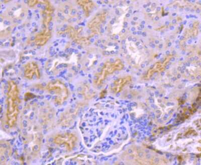 Immunohistochemistry-Paraffin: TrkA Antibody (JJ084-04) [NBP2-67473]