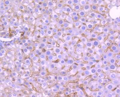 Immunohistochemistry-Paraffin: TrkA Antibody (JJ084-04) [NBP2-67473]