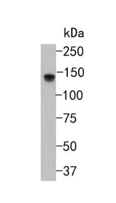 Western Blot: TrkA Antibody (JJ084-04) [NBP2-67473]