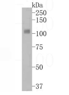 Western Blot: TrkA Antibody (JJ084-04) [NBP2-67473]