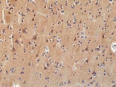 Immunohistochemistry-Paraffin: TrkA Antibody (RM423) [NBP3-09176]