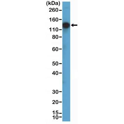 Western Blot: TrkA Antibody (RM423) [NBP3-09176]