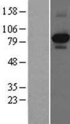 Western Blot: TrkA Overexpression Lysate [NBL1-13833]