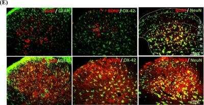 Immunocytochemistry/ Immunofluorescence: TrkB [p Tyr816] Antibody [NBP1-03499]