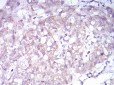 Immunohistochemistry-Paraffin: TrkB Antibody (10B6C4) - BSA Free [NBP2-52524]