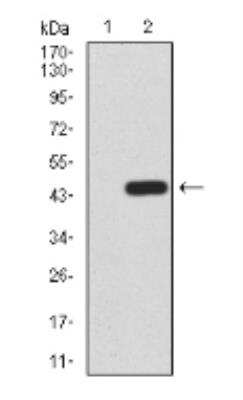 Western Blot: TrkB Antibody (10B6C4)BSA Free [NBP2-52524]