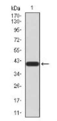 Western Blot: TrkB Antibody (10B6C4)BSA Free [NBP2-52524]