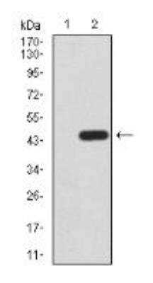 Western Blot: TrkB Antibody (8D2E8)BSA Free [NBP2-52523]