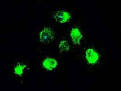Immunocytochemistry/ Immunofluorescence: TrkB Antibody (OTI2E1) - Azide and BSA Free [NBP2-74624]