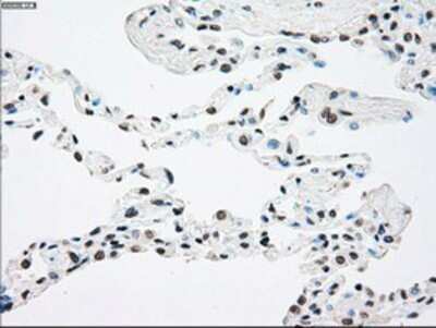 Immunohistochemistry: TrkB Antibody (OTI2E1) - Azide and BSA Free [NBP2-74624]