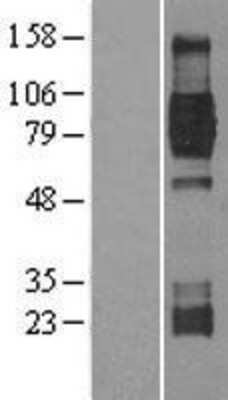 Western Blot: TrkB Overexpression Lysate [NBL1-13836]