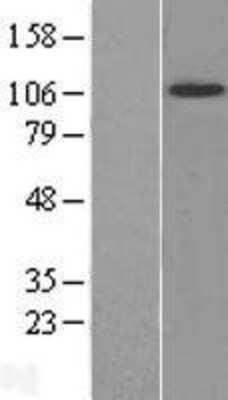 Western Blot: TrkB Overexpression Lysate [NBL1-13837]