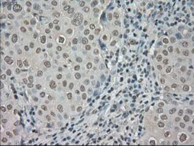 Immunohistochemistry-Paraffin: TrkC Antibody (OTI2B8) [NBP1-47900]
