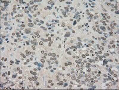 Immunohistochemistry-Paraffin: TrkC Antibody (OTI2B8) [NBP1-47900]