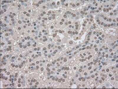 Immunohistochemistry-Paraffin: TrkC Antibody (OTI2B8) [NBP1-47900]