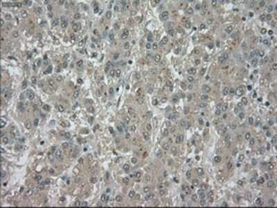 Immunohistochemistry-Paraffin: TrkC Antibody (OTI2B8) [NBP1-47900]