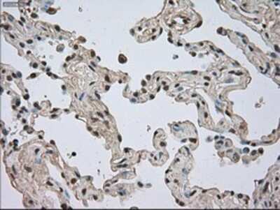 Immunohistochemistry-Paraffin: TrkC Antibody (OTI2B8) [NBP1-47900]