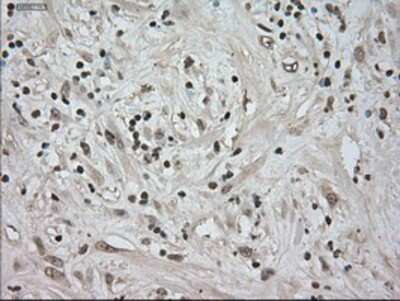 Immunohistochemistry-Paraffin: TrkC Antibody (OTI2B8) [NBP1-47900]