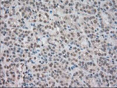 Immunohistochemistry-Paraffin: TrkC Antibody (OTI2B8) [NBP1-47900]