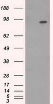 Western Blot: TrkC Antibody (OTI2B8) [NBP1-47900]