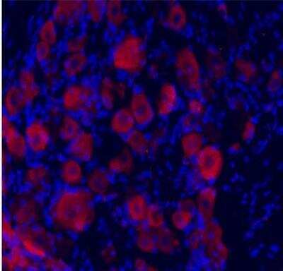 Immunocytochemistry/ Immunofluorescence: TrkC Antibody [NB100-98829]