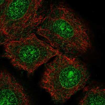 Immunocytochemistry/ Immunofluorescence: TrkC Antibody [NBP2-58383]