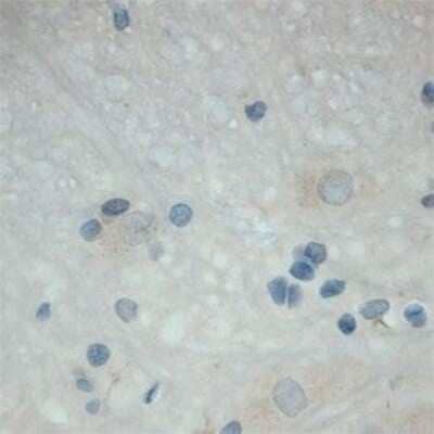 Immunohistochemistry: TrkC Antibody [NB100-98829]