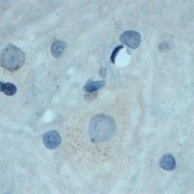 Immunohistochemistry: TrkC Antibody [NB100-98829]