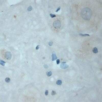 Immunohistochemistry: TrkC Antibody [NB100-98829]