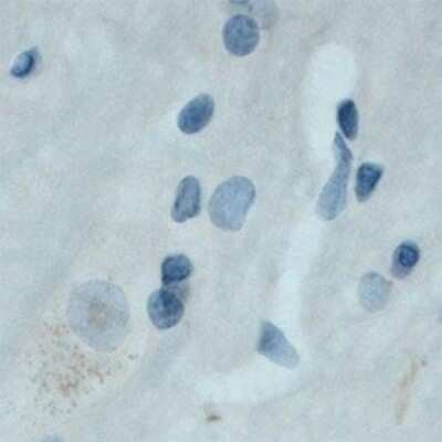 Immunohistochemistry: TrkC Antibody [NB100-98829]