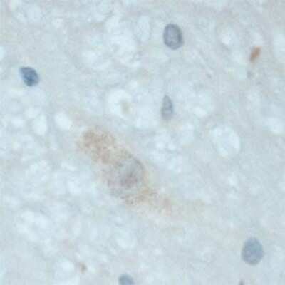 Immunohistochemistry: TrkC Antibody [NB100-98829]