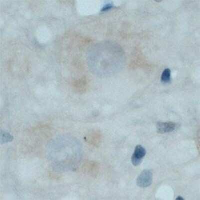Immunohistochemistry: TrkC Antibody [NB100-98829]