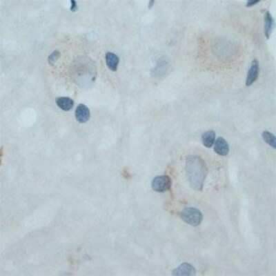 Immunohistochemistry: TrkC Antibody [NB100-98829]