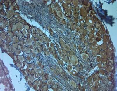 Immunohistochemistry-Paraffin: TrkC Antibody [NB100-98829]