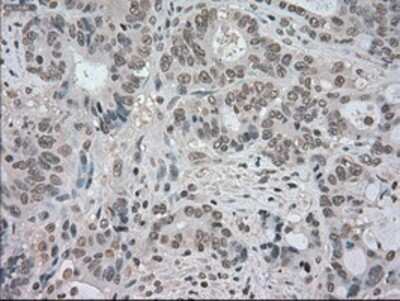 Immunohistochemistry: TrkC Antibody (OTI2B8) - Azide and BSA Free [NBP2-74626]